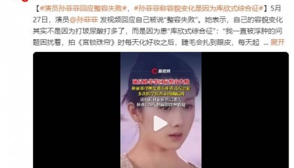 演员孙菲菲回应整容失败！称容貌变化是因为患“库欣式综合征”