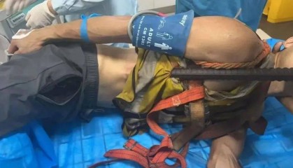 佛山一男子意外从高空坠落，1.5米长钢筋从肛门贯穿胸腔......