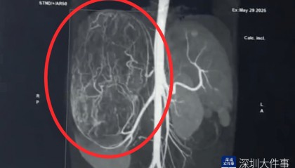 店员试衣间里一句警告，竟救了17岁少女！一家人火速赶到深圳